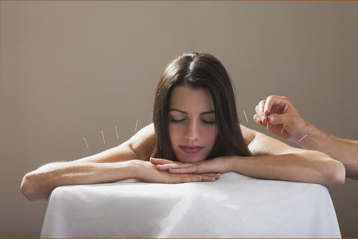 acupuntura na recuperação muscular